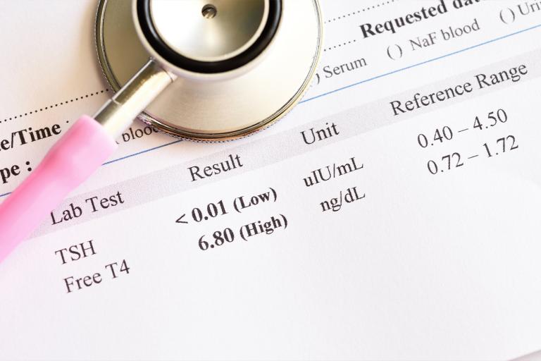 Abnormal thyroid hormone test result.